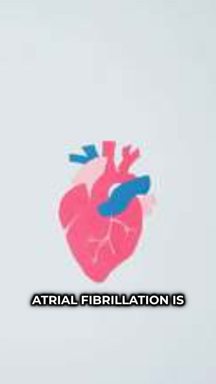 Understanding Atrial Fibrillation